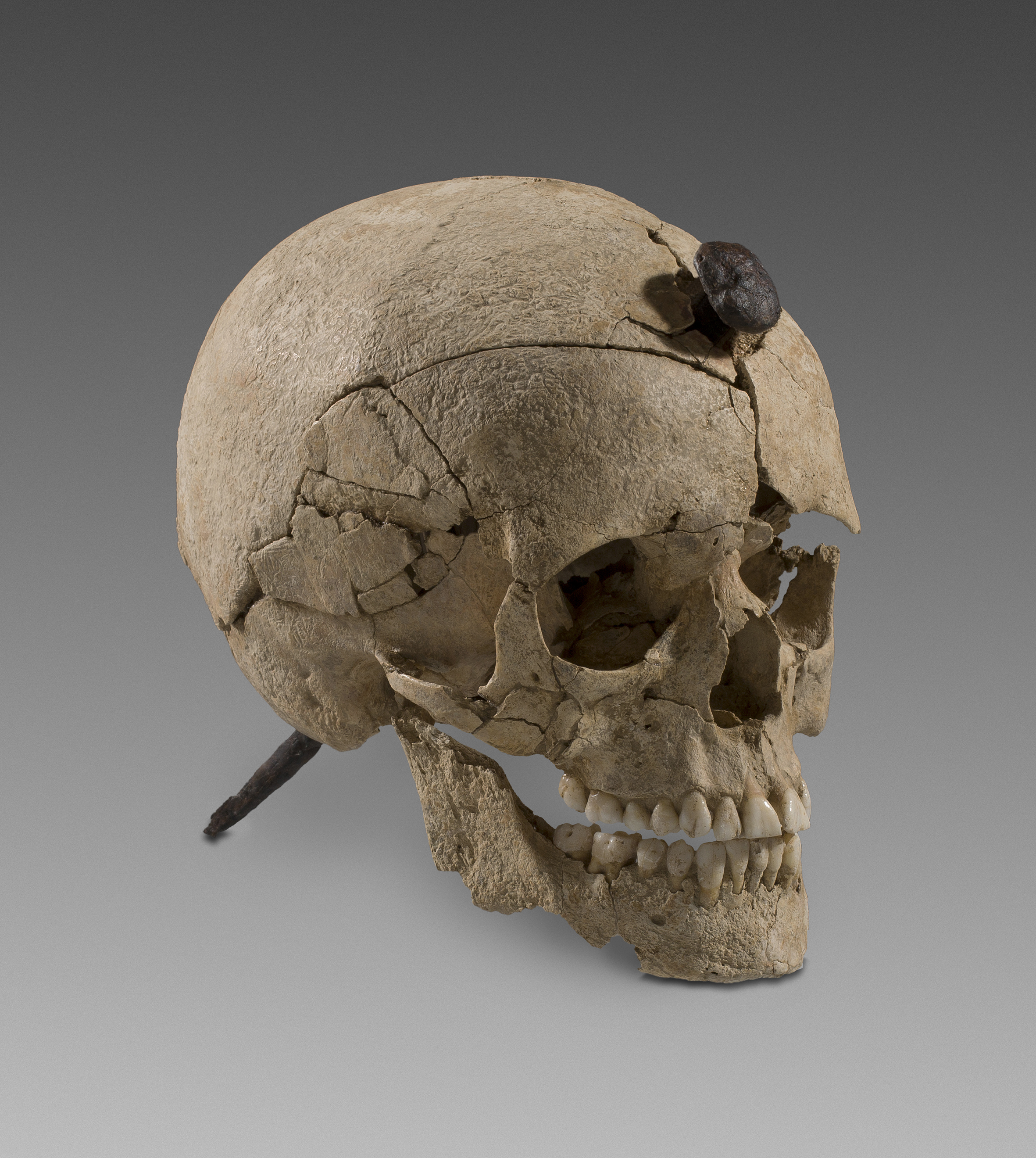 Crani travessat per un clau de ferro